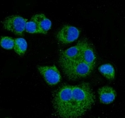 Immunofluorescent staining of FFPE human T-47D cells with CPT1-L antibody (green) and DAPI nuclear stain (blue). HIER: steam section in pH6 citrate buffer for 20 min.