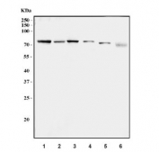 Western blot testing of 1) human MCF7, 2) human RT-4, 3) rat liver, 4) rat kidney, 5) mouse liver and 6) mouse kidney tissue lysate with CPT1-L antibody. Predicted molecular weight ~86 kDa.