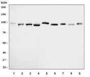Western blot testing of 1) human HeLa, 2) human HACAT, 3) human RT-4, 4) human T-47D, 5) rat brain, 6) rat PC-12, 7) mouse brain, 8) mouse testis and 9) mouse lung tissue lysate with CTNND1 antibody. Predicted molecular weight of isoform 1: 102-108 kDa and isoform 2: 95-102 kDa.