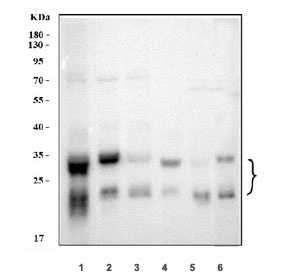 Western blot testing of 1) human U-87 MG, 2) human HepG2, 3) human A549, 4) rat brain, 5) rat liver and 6) mouse liver tissue lysate with CTSB antibody.  Molecular weight: 38-46 kDa depending on glycosylation level. An ~31 kDa form (propeptide removed) may be observed and may be further processed into an ~25 kDa heavy chain and ~5 kDa light chain.