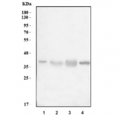 Western blot testing of 1) human HepG2, 2) human HCCT, 3) human HCCP and 4) mouse liver tissue lysate with CTSL antibody.  Expected molecular weight: 38-41 kDa with multiple smaller processed/active forms.