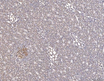 IHC staining of FFPE rat kidney tissue with Cathepsin L antibody. HIER: boil tissue sections in pH8 EDTA for 20 min and allow to cool before testing.