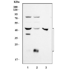 Western blot testing of 1) rat liver, 2) rat kidney and 3) mouse liver tissue lysate with Cathepsin L antibody. Expected molecular weight: 38-41 kDa with multiple smaller processed/active forms.