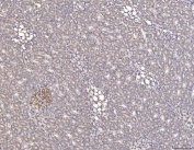 IHC staining of FFPE rat kidney tissue with Cathepsin L antibody. HIER: boil tissue sections in pH8 EDTA for 20 min and allow to cool before testing.