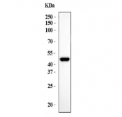 Western blot testing of human COLO-320 cell lysate with CXCR2 antibody. Predicted molecular weight ~40 kDa.