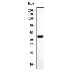 Western blot testing of human COLO-320 cell lysate with CXCR2 antibody. P
