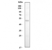 Western blot testing of human HCCP cell lysate with Cytochrome P450 3A4 antibody. Expected molecular weight: 50-57 kDa.