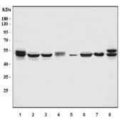 Western blot testing of human 1) placenta, 2) HepG2, 3) HCCT, 4) HCCP, 5) U-87 MG, 6) MCF7, 7) SK-O-V3 and 8) SiHa cell lysate with Aromatase antibody. Predicted molecular weight ~58 kDa.