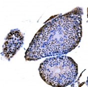 IHC staining of FFPE mouse testis tissue with DMC1 antibody. HIER: boil tissue sections in pH8 EDTA for 20 min and allow to cool before testing.