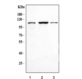 Western blot testing of human 1) 293T, 2) HCCT and 3) HepG2 cell lysate wi