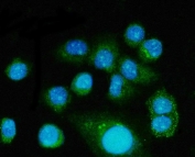 Immunofluorescent staining of FFPE human SiHa cells with Fibroblast Growth Factor 2 antibody (green) and DAPI nuclear stain (blue). HIER: steam section in pH6 citrate buffer for 20 min.