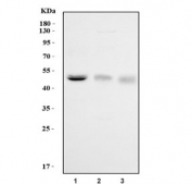 Western blot testing of 1) human Jurkat, 2) rat ovary and 3) mouse ovary tissue lysate with FOXL2 antibody. Predicted molecular weight ~38 kDa, but can be observed at 45-50 kDa.