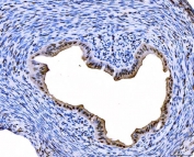 IHC staining of FFPE rat ovary tissue with FOXL2 antibody. HIER: boil tissue sections in pH8 EDTA for 20 min and allow to cool before testing.