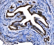 IHC staining of FFPE mouse ovary tissue with FOXL2 antibody. HIER: boil tissue sections in pH8 EDTA for 20 min and allow to cool before testing.