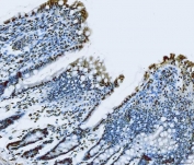 IHC staining of FFPE rat colon tissue with TLS antibody. HIER: boil tissue sections in pH8 EDTA for 20 min and allow to cool before testing.