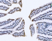 IHC staining of FFPE mouse colon tissue with TLS antibody. HIER: boil tissue sections in pH8 EDTA for 20 min and allow to cool before testing.