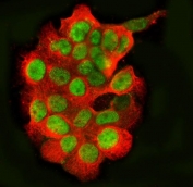 Immunofluorescent staining of FFPE human A431 cells with TLS antibody (green) and Phalloidin (red). HIER: steam section in pH6 citrate buffer for 20 min.