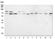 Western blot testing of 1) human HeLa, 2) human K562, 3) human 293T, 4) human Caco-2, 5) human Jurkat, 6) human HL60, 7) human HepG2, 8) human SH-SY5Y, 9) rat brain, 10) rat PC-12 and 11) mouse NIH 3T3 cell lysate with TLS antibody. Predicted molecular weight ~53 kDa but routinely observed at up to ~75 kDa.