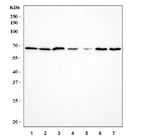 Western blot testing of human 1) Jurkat, 2) 293T, 3) A549, 4) MDA-MB-453, 5) U-87 MG, 6) Caco-2 and 7) Raji cell lysate with G3BP1 antibody. Predicted molecular weight ~52 kDa but routinley observed at up to ~68 kDa.