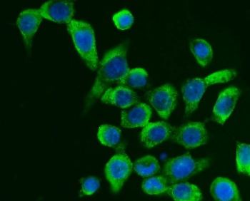 Immunofluorescent staining of FFPE human Caco-2 cells with G3BP1 antibody (green) and DAPI nuclear stain (blue). HIER: steam section in pH6 citrate buffer for 20 min.