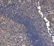 IHC staining of FFPE human tonsil tissue with G3BP1 antibody. HIER: boil tissue sections in pH8 EDTA for 20 min and allow to cool before testing.