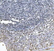 IHC staining of FFPE human tonsil tissue with GADD45B antibody. HIER: boil tissue sections in pH8 EDTA for 20 min and allow to cool before testing.