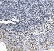 IHC staining of FFPE human tonsil tissue with GADD45B antibody. HIER: boil tissue sections in pH8 EDTA for 20 min and allow to cool before testing.