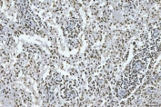 IHC staining of FFPE human spleen tissue with GADD45B antibody. HIER: boil tissue sections in pH8 EDTA for 20 min and allow to cool before testing.