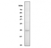 Western blot testing of human MCF7 cell lysate with GADD45B antibody. Predicted molecular weight ~18 kDa.