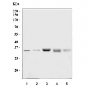 Western blot testing of 1) human Jurkat, 2) human HepG2, 3) rat liver, 4) mouse kidney and 5) mouse liver tissue lysate with GAS2 antibody. Predicted molecular weight ~35 kDa.