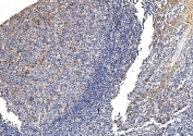 IHC staining of FFPE human tonsil tissue with GFPT1 antibody. HIER: boil tissue sections in pH8 EDTA for 20 min and allow to cool before testing.