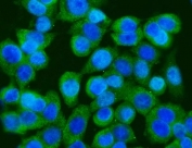 Immunofluorescent staining of FFPE human Caco-2 cells with GFPT1 antibody (green) and DAPI nuclear stain (blue). HIER: steam section in pH6 citrate buffer for 20 min.