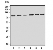 Western blot testing of human 1) HepG2, 2) HeLa, 3) 293T, 4) MCF7, 5) Caco-2 and 6) HEL cell lysate with GFPT1 antibody. Predicted molecular weight ~79 kDa.