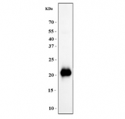 Western blot testing of human placental tissue with GH1 antibody. Predicted molecular weight: 22-25 kDa.