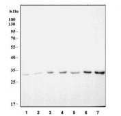 Western blot testing of 1) human PC-3, 2) human RT4, 3) human U-251, 4) rat liver, 5) rat kidney, 6) mouse liver and 7) mouse kidney tissue lysate with GJB2 antibody. Predicted molecular weight: ~26 kDa.