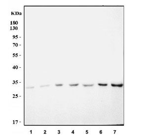 Western blot testing of 1) human PC-3, 2) human RT4, 3) human U-251, 4) rat liver, 5) rat kidney, 6) mouse liver and 7) mouse kidney tissue lysate with GJB2 antibody. Predicted molecular weight: ~26 kDa.