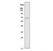 Western blot testing of U-87 MG cell lysate with Glutaminase 2 antibody. Predicted molecular weight ~66 kDa.
