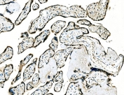 IHC staining of FFPE human placental tissue with GRHL2 antibody. HIER: boil tissue sections in pH8 EDTA for 20 min and allow to cool before testing.