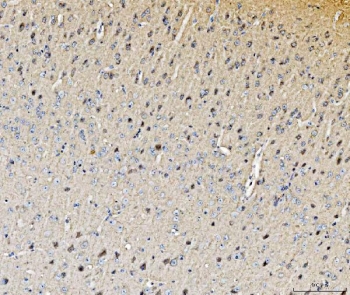 IHC staining of FFPE mouse brain tissue with Histidine decarboxylase antibody. HIER: boil tissue sections in pH8 EDTA for 20 min and allow to cool before testing.~