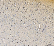 IHC staining of FFPE mouse brain tissue with Histidine decarboxylase antibody. HIER: boil tissue sections in pH8 EDTA for 20 min and allow to cool before testing.