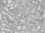 IHC staining of FFPE human splenic rupture tissue with IMPDH1 antibody. HIER: boil tissue sections in pH8 EDTA for 20 min and allow to cool before testing.