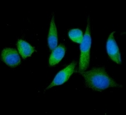 Immunofluorescent staining of FFPE human PC-3 cells with IMPDH1 antibody (green) and DAPI nuclear stain (blue). HIER: steam section in pH6 citrate buffer for 20 min.