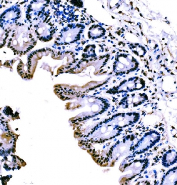 IHC staining of FFPE mouse stomach tissue with Krueppel-like factor 4 antibody. HIER: boil tissue sections in pH8 EDTA for 20 min and allow to cool before testing.