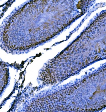 IHC staining of FFPE rat testis with Importin subunit alpha-1 antibody. HIER: boil tissue sections in pH8 EDTA for 20 min and allow to cool before testing.