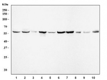 Western blot testing of 1) human A549, 2) human U-251, 3) human U-2 OS, 4) human Daudi, 5) human MCF7, 6) human T-47D, 7) human Caco-2, 8) rat testis, 9) mouse testis and 10) mouse RAW264.7 cell lysate with Importin subunit alpha-1 antibody. Predicted molecular weight ~58 kDa.