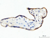 IHC staining of FFPE human placental tissue with Keratin 7 antibody. HIER: boil tissue sections in pH8 EDTA for 20 min and allow to cool before testing.