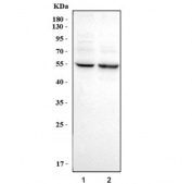 Western blot testing of human 1) HeLa and 2) RT-4 cell lysate with Keratin 7 antibody. Predicted molecular weight ~51 kDa.