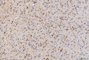 IHC staining of FFPE rat brain tissue with LNPEP antibody. HIER: boil tissue sections in pH8 EDTA for 20 min and allow to cool before testing.
