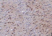 IHC staining of FFPE mouse brain tissue with LNPEP antibody. HIER: boil tissue sections in pH8 EDTA for 20 min and allow to cool before testing.