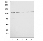 Western blot testing of human 1) HeLa, 2) 293T, 3) Daudi, 4) T-47D and 5) RT-4 cell lysate with LNPEP antibody. Predicted molecular weight ~117 kDa.